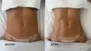 Up to 51% Off on Lymphatic Drainage Massage at Shaped Beautifully
