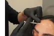 Up to 41% Off on Injection - Filler and Freezer at S.T. Medspa - Second Medium