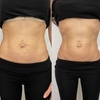 Image 2: Explore HIFU Treatments for Face, Neck, and Body