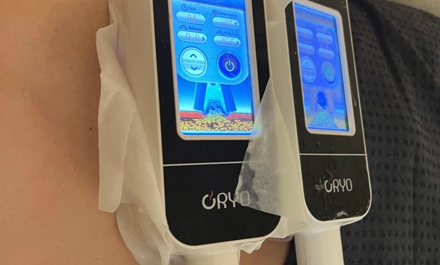 Image 3: Up to 82% Off on Fat Reduction - Non-Branded at L.A. Fat Freeze