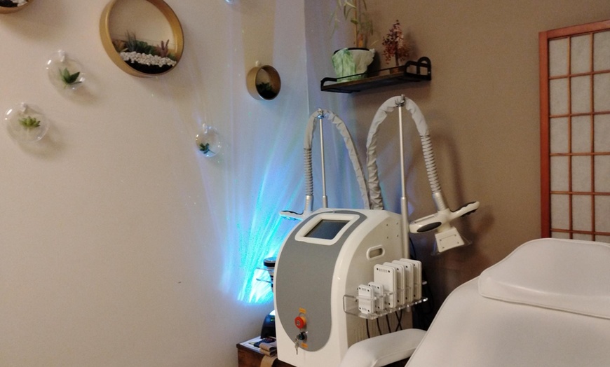 Image 6: Get Fat Freeze Treatment at Functionised Integrative Therapeutics