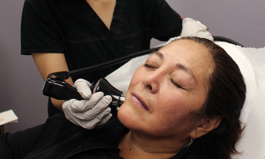 Image 2: One Laser Hair-Reduction Session at Raw Aesthetics Wellness MED SPA