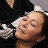 Image 2: One Laser Hair-Reduction Session at Raw Aesthetics Wellness MED SPA