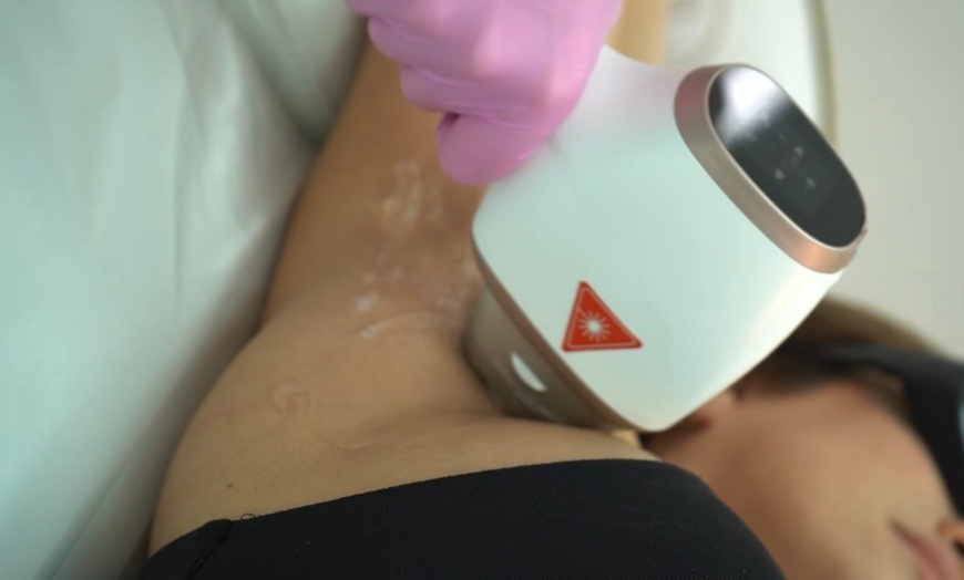 Image 1: Up to 80% Off on Laser Hair Removal at HL Lasers