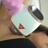 Image 1: Up to 80% Off on Laser Hair Removal at HL Lasers