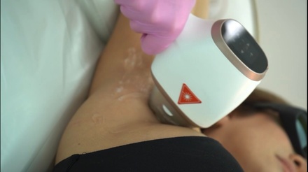 Three Laser Hair-Removal Sessions on One Small Area - HL Lasers