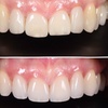 Image 2: Dental Crowns, Dental Exam, X-rays & Cleaning, Dentures & More