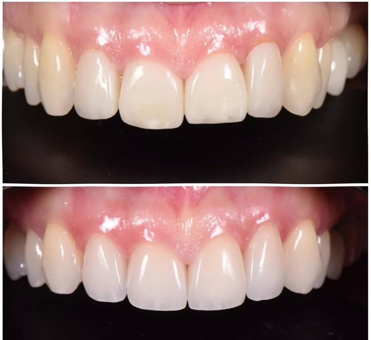 Dental Crowns, Dental Exam, X-rays & Cleaning, Dentures & More