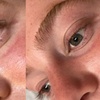 Image 7: Lash and Brow Lifting Treatments