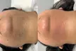 Ultimate Smoothness with Skin Beauty By Thalita's 1,3, or 6 Laser Hair Removal For 2 Small Areas (Up to 55% Off) - Second Medium
