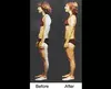 Enhance Your Fitness with One Rolfing Structural Integration Session at 805 Rolfing And Massage (Up to 70% Off)