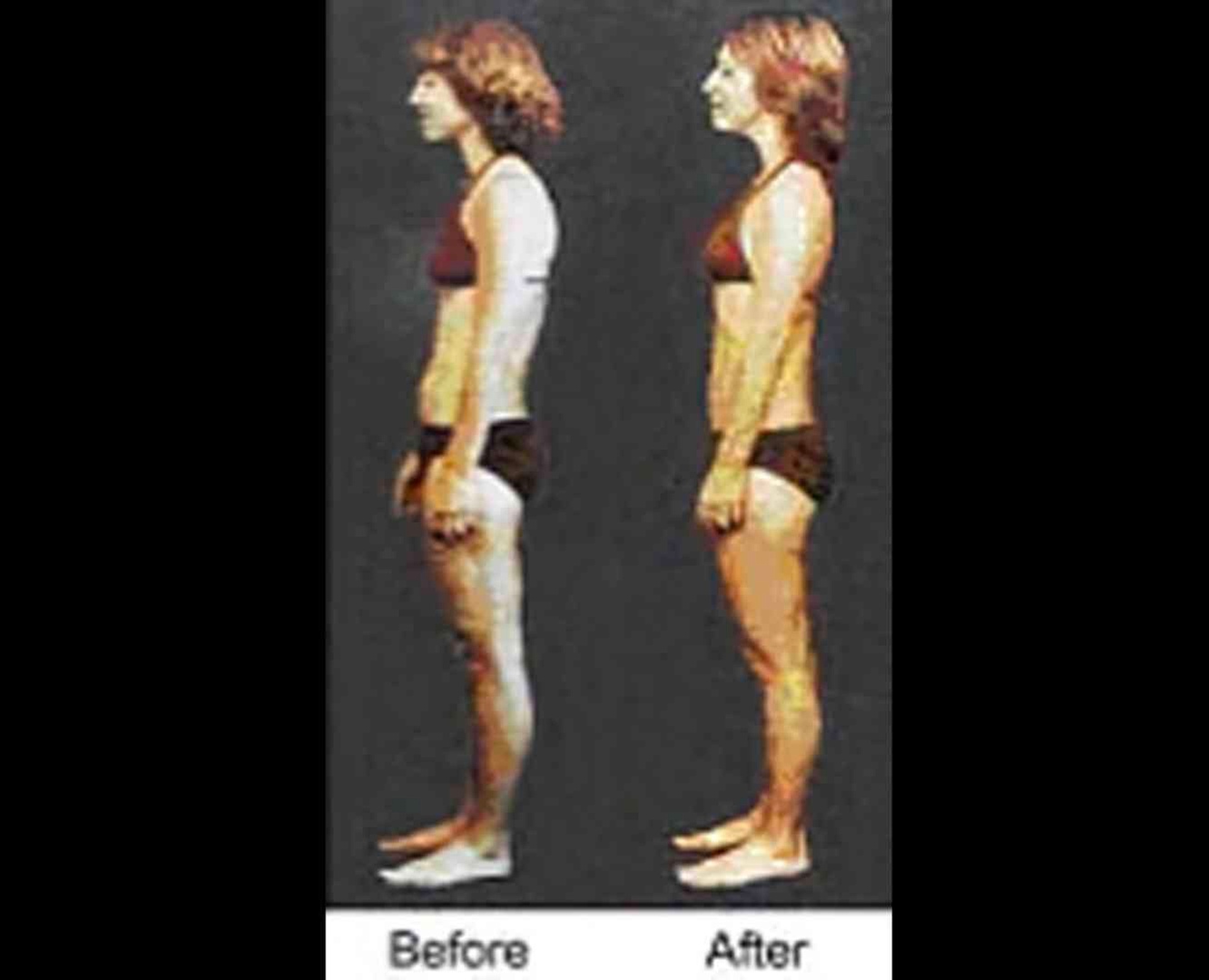 Enhance Your Fitness with One Rolfing Structural Integration Session