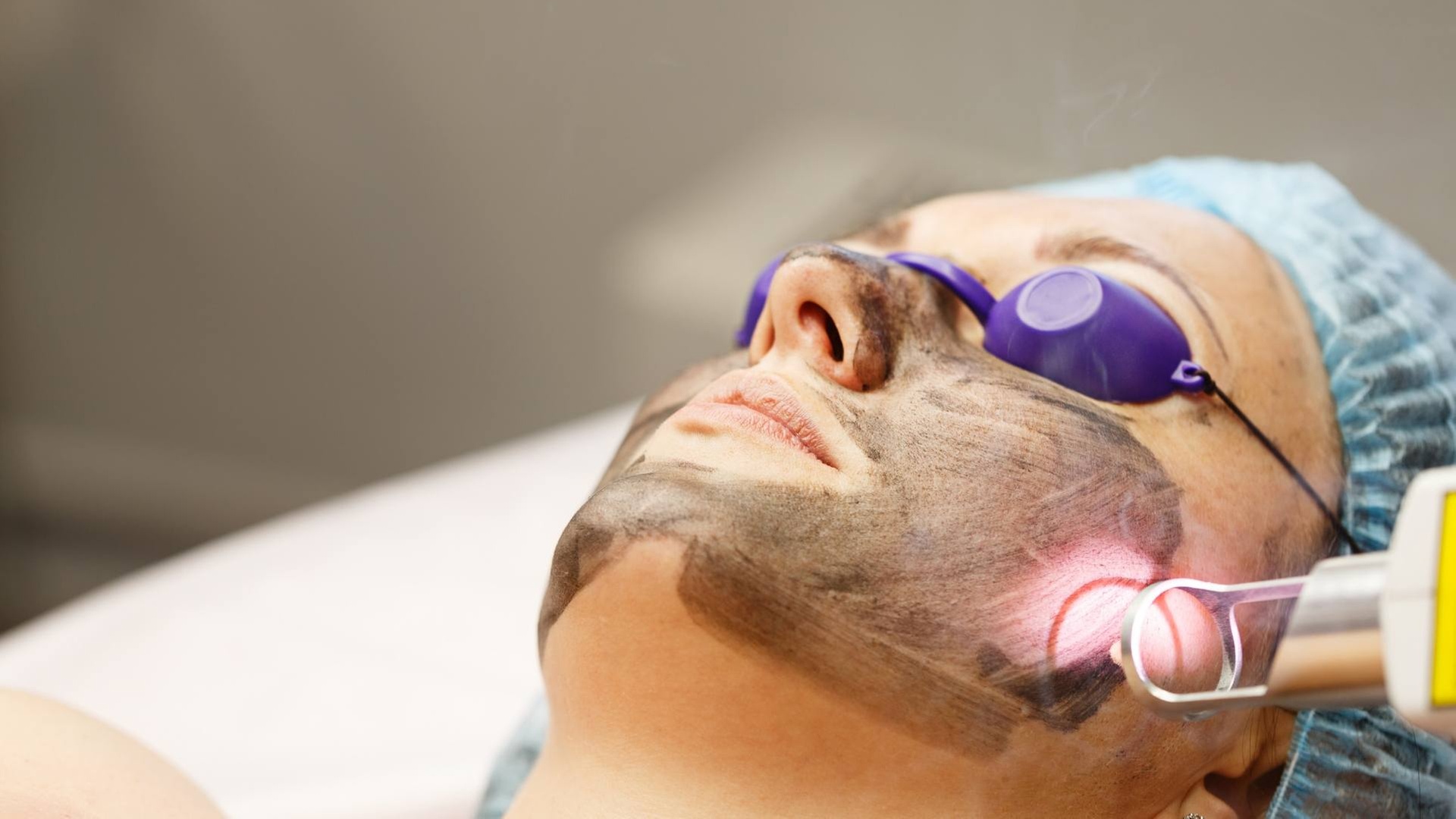 Unlock Radiance with Regeneris Medical's Hollywood Facial, featuring 1 Carbon Peel, up to 40% off for a transformative glow