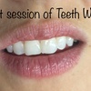 Image 2: Up to 50% Off on Teeth Whitening at Evolve Beauty Bar