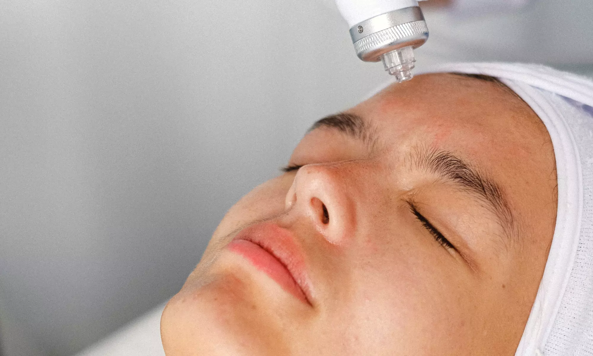 Up to 67% Off on Laser Skin Resurfacing - Branded at YJ Skin Solution