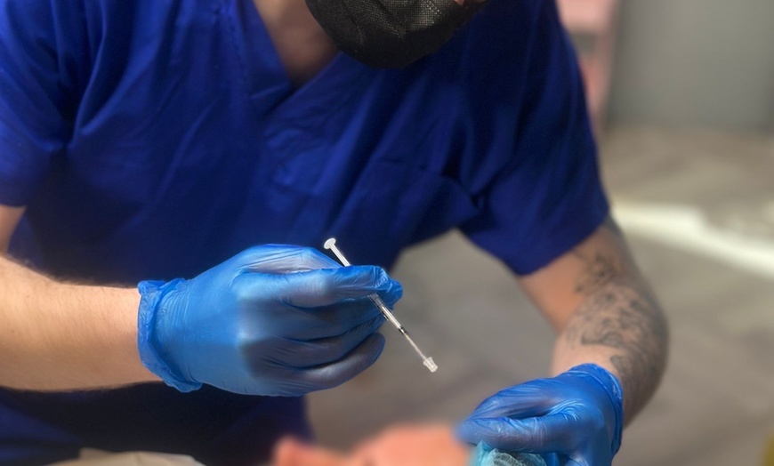 Image 2: Up to 68% Off on Injection - Dermal Filler at Hair & Aesthetics By Ryan