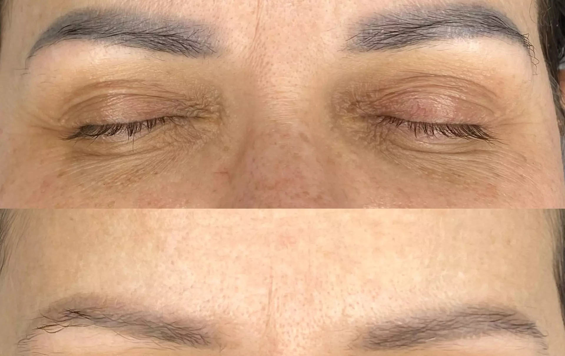 Laserowe oraz bezlaserowe usuwanie makijażu permanentnego brwi i ust