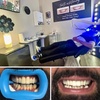 Image 1: 50% Off for In-Office Teeth Whitening with Optional High-Power Booster