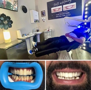One 60-Minute Wellness In-Office LED Teeth-Whitening Treatment for One. - ADVANCED TEETH WHITENING BEAUTY STUDIO