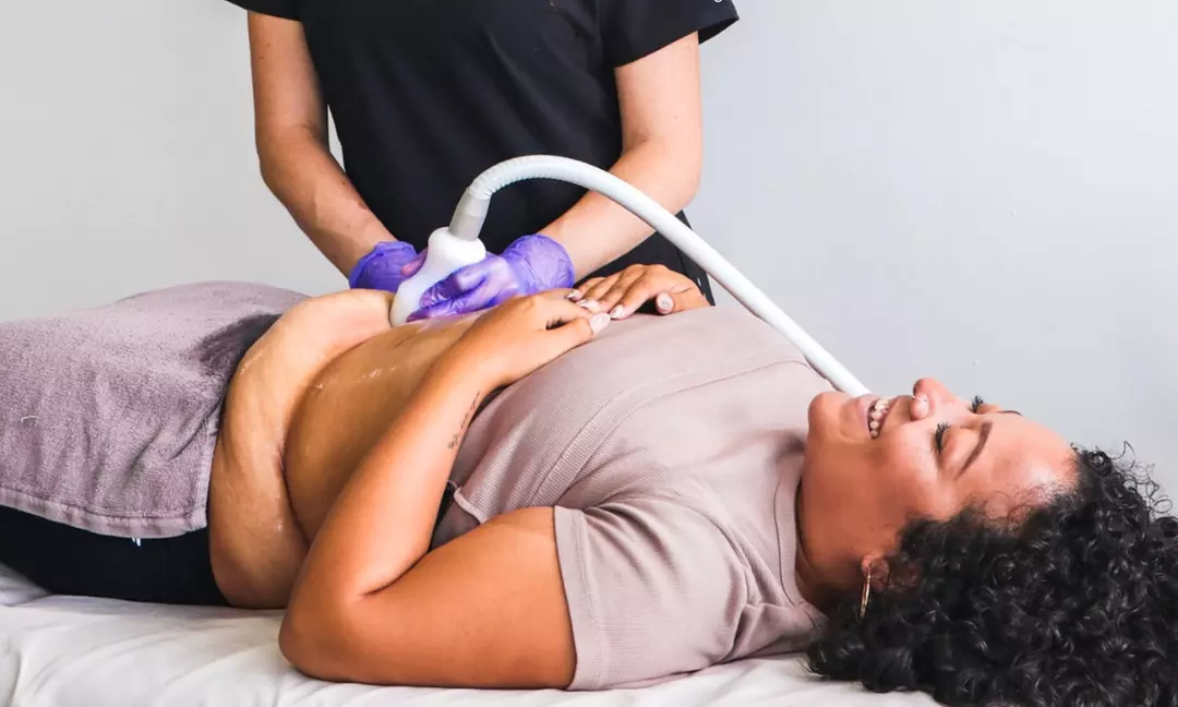 Up to 47% Off on Body Sculpting (Cryolipolysis)