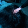 Image 3: Cold & Hot Plasma Fusion Rejuvenation for Youthful Skin