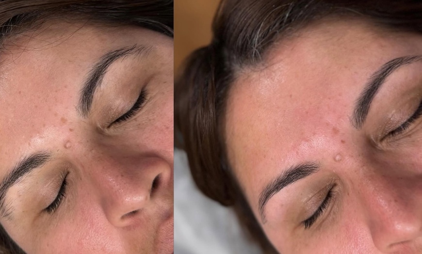 Image 2: Brazilian & Lower Leg Waxing Package – Includes 3 Brazilian Sessions