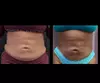 Experience Southern Shapez with ultrasonic fat reduction options and enjoy up to 56% off amazing sculpting sessions