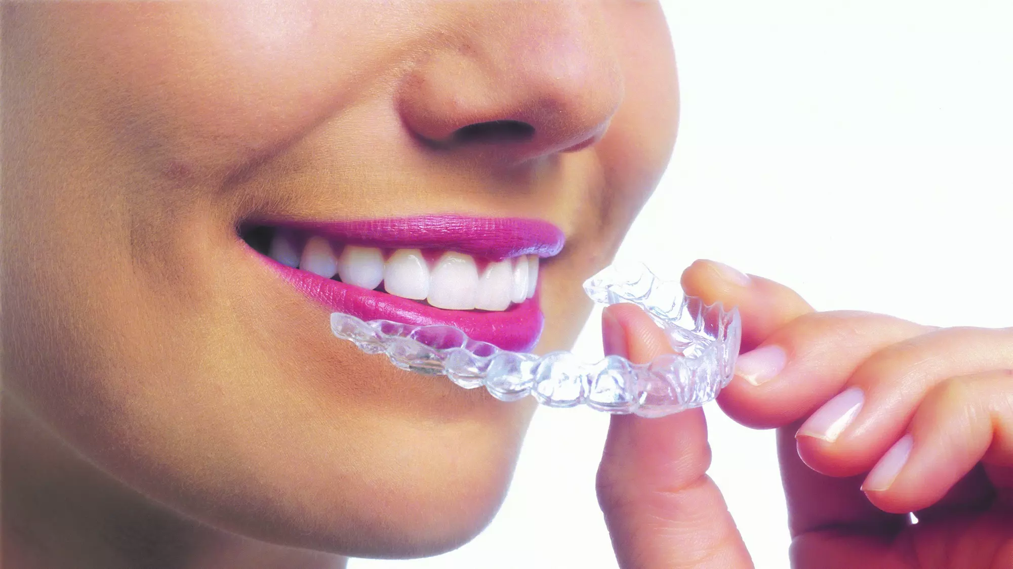 Up to 60% Off on Invisalign at RK Dental Care - Primary Image