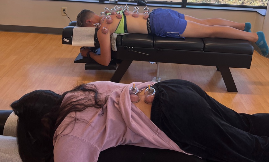 Image 3: Up to 37% Off on Cupping at Navigate Health Chiropractic