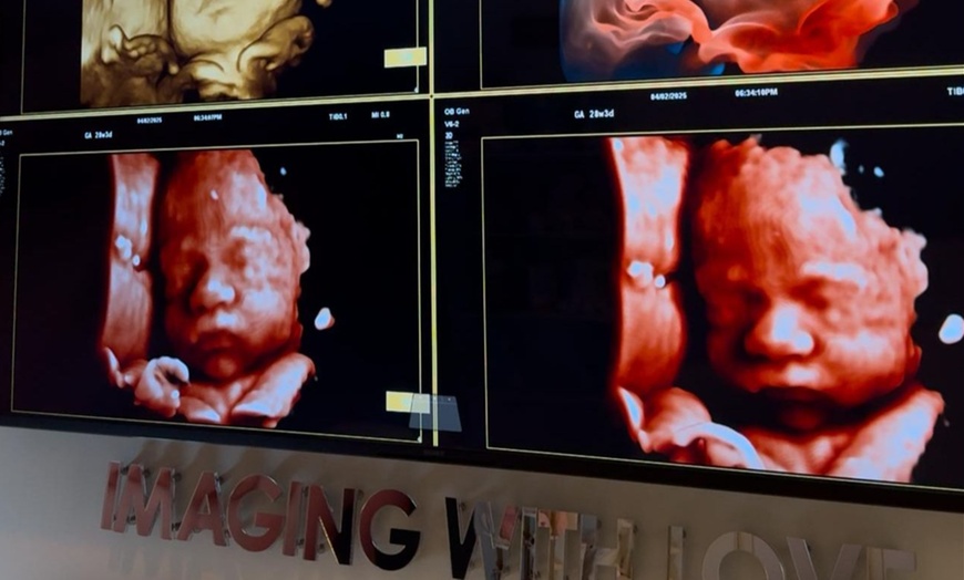 Image 4: Up to 32% Off on Ultrasound - 3D / 4D at Imaging With Love 3D/4D/5D & 8K Pregnancy Ultrasounds in Miami – At Home & In Office