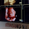 Image 4: Up to 39% Off on Ultrasound - 3D / 4D at Imaging With Love 3D/4D/5D & 8K Pregnancy Ultrasounds in Miami – At Home & In Office