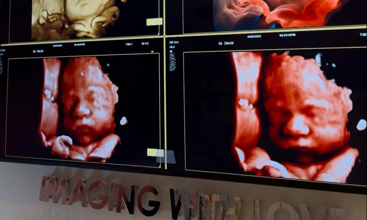See Baby in Real-Time with 45-Minute 2D/3D/4D/5D Ultrasound
