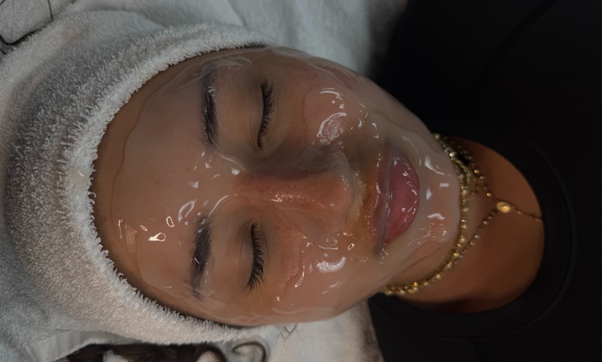Image 4: One, Two or Three Sessions of Facial with Microdermabrasion & LED 