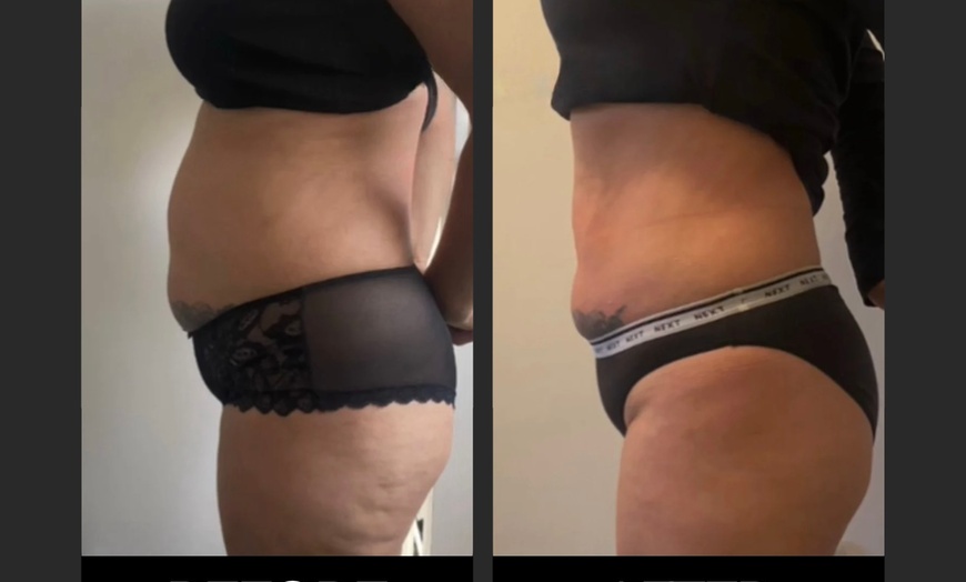 Image 1: One 30-Min EMS Body Contouring session on the Abdomen or on the Glute