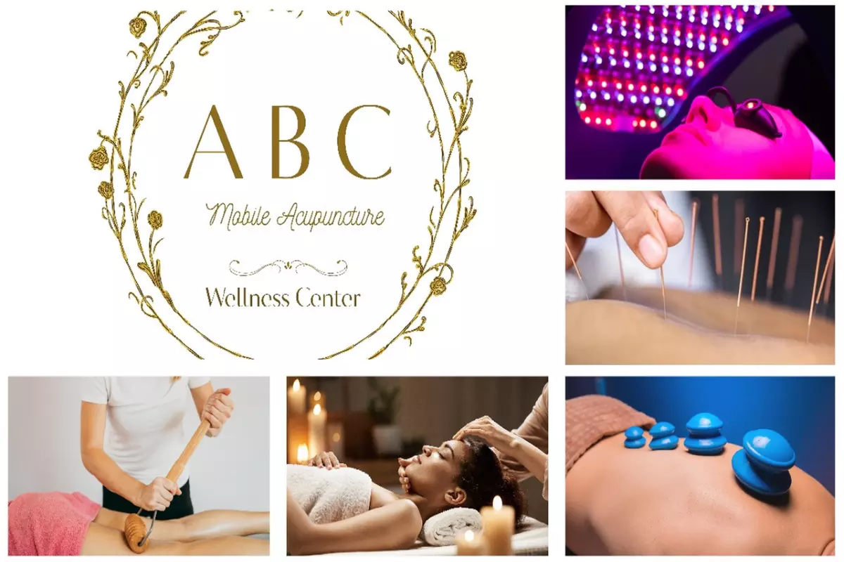 Acupuncture Cupping Scraping Hot-towel compression, Massage or More