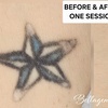 Image 3: Bellagena Offers Three Laser Tattoo Removal Sessions for Small, X-Small, or XX-Small Areas (Up to 56% Off)