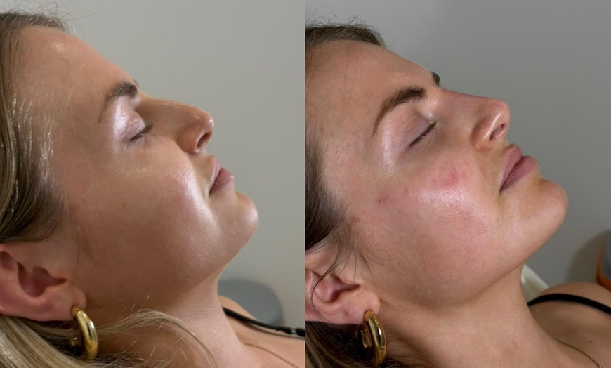 Image 2: Up to 47% Off on Cavitation at Morgan Taylor Beauty Lounge