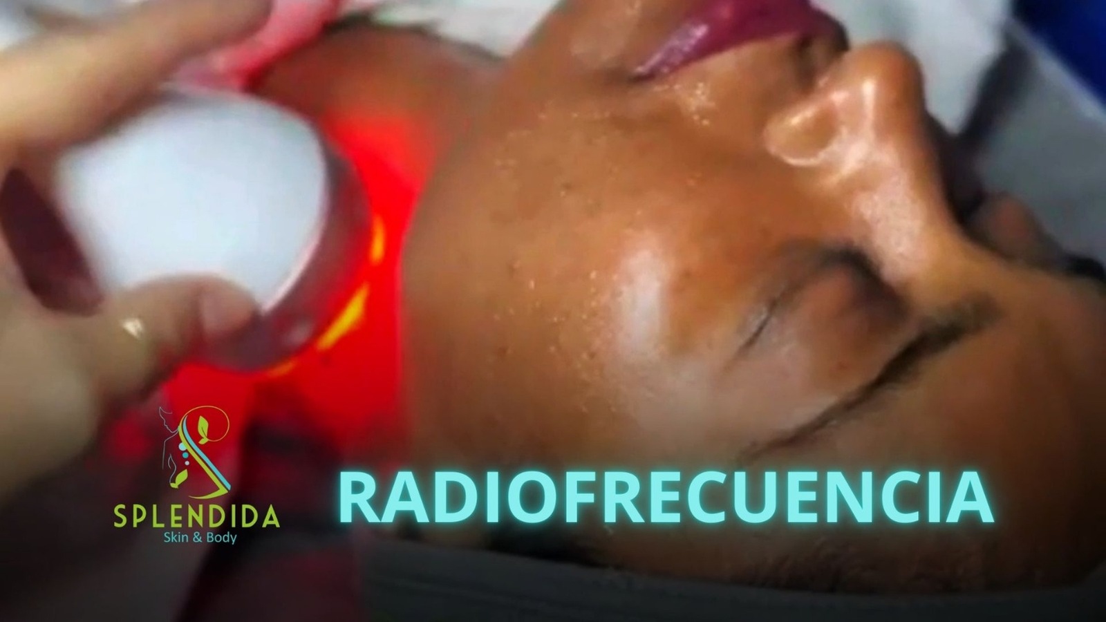 Experience Splendida Salon and Spa's Microdermabrasion Facial with Lifting, Radiofrequency, Ultrasound, Phototherapy LED up to 50% off