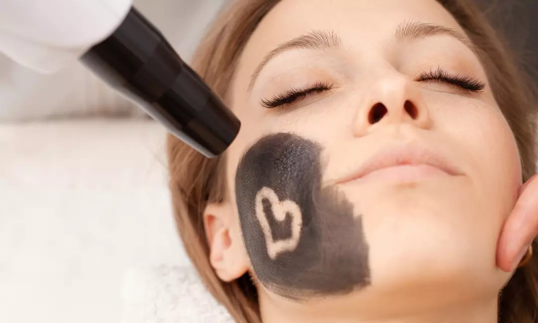 Peeling węglowy Black Doll dla zdrowej i promiennej skóry w Permanent Makeup & Laser Sylwia Kasza (do -45%) - Image 4