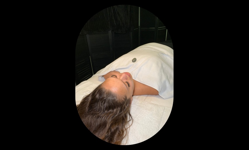 Image 4: Up to 44% Off on Facial at Zydrate Skin