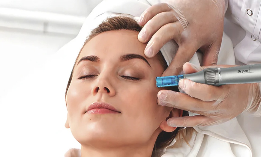 Image 1: Up to 60% Off on Micro-Needling at SKINOVA Beauty and Laser Clinic