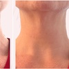 Image 4: Up to 90% Off on Facelift - Non-Surgical at The Body Edit