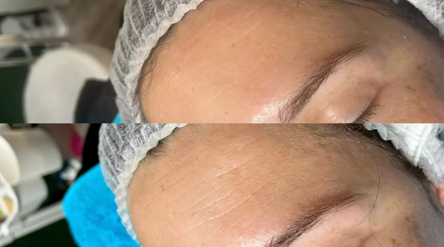 Soin visage liftant coréen, Hydra boost ou Carbon Peeling