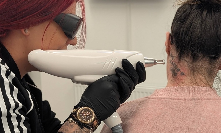 Image 3: Up to 55% Off on Tattoo Removal at Gia laser clinic