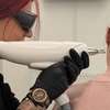 Image 3: Up to 55% Off on Tattoo Removal at Gia laser clinic