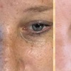 Image 1: Advanced Chemical Peel or 2-Hour Anti-Aging Facial at RISE Skin Spa