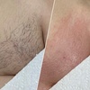 Image 1: Get Brazilian/Bikini Wax, Vajacial or  Men's Brazilian/ Bikini Wax