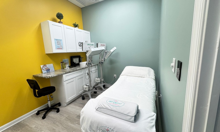 Image 5: 1, or 2 Syringes of Juvéderm Ultra, or Ultra Plus XC at Sha's Medspa
