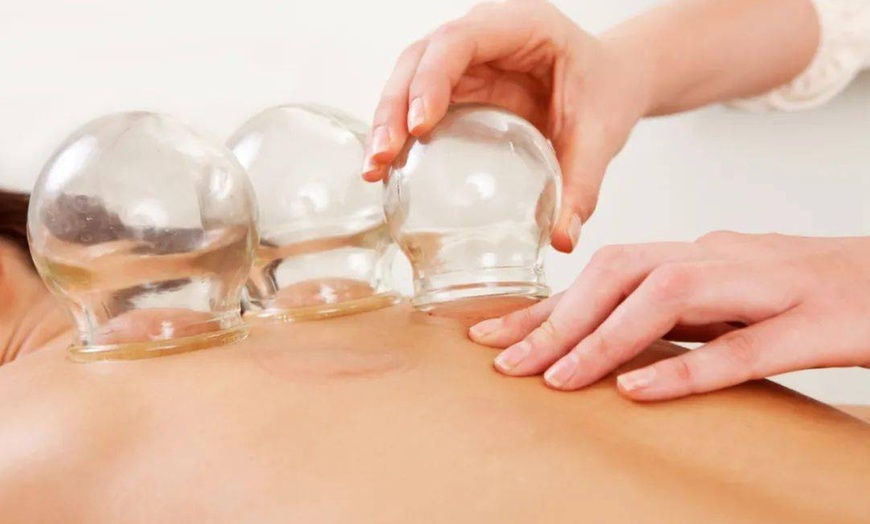 Image 1: Boost Wellness With Our Soothing Cupping Therapy