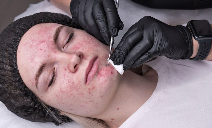 Image 3: 60 Min. Gesichtsbehandlung mit Tiefenreinigung und optionaler Massage